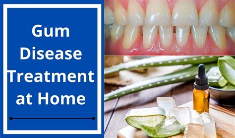 gum disease treatment near me|How to Treat Gum Disease .